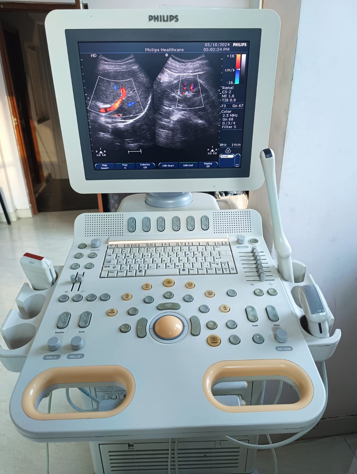 Philips ultrasound machine Model No HD7 - OSMANI BIOMEDICAL ELECTRONICS