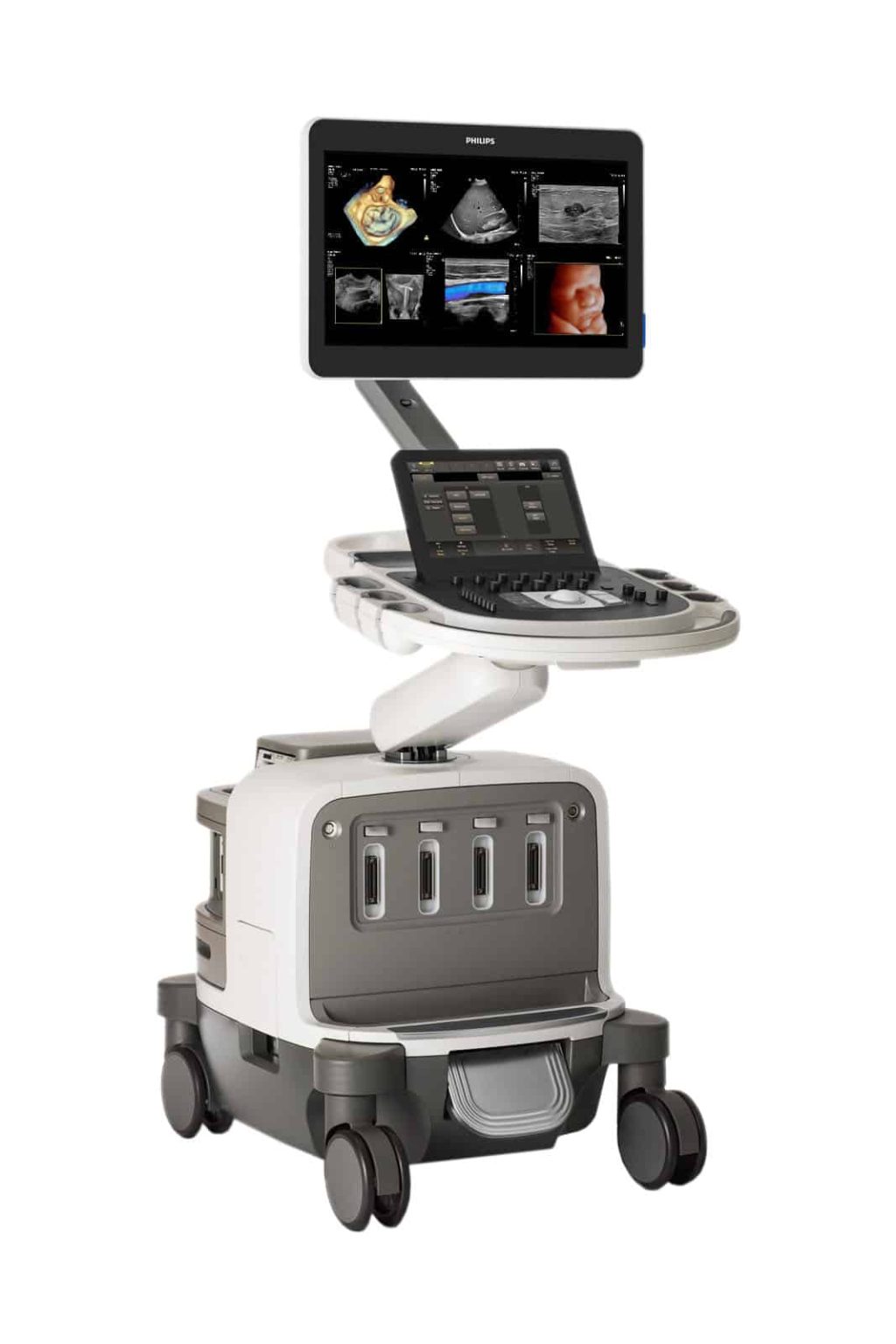 Philips Epiq Elite - OSMANI BIOMEDICAL ELECTRONICS
